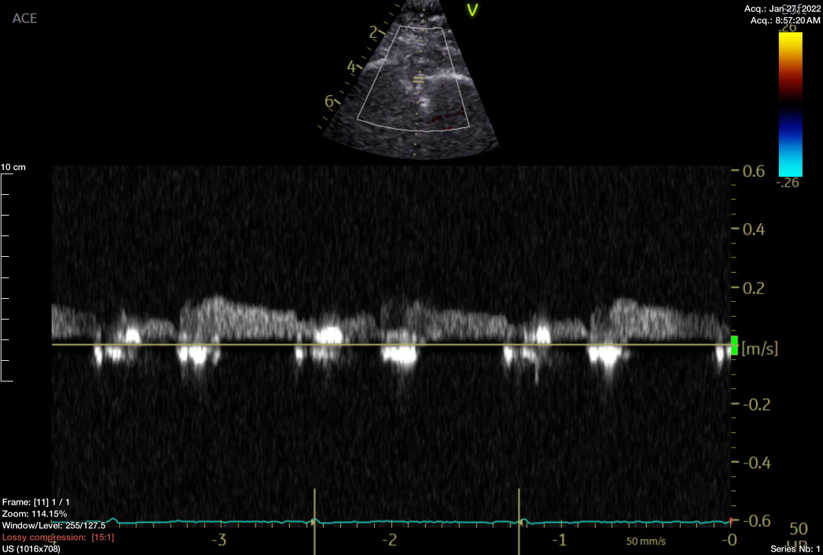 Live PWD DICOM