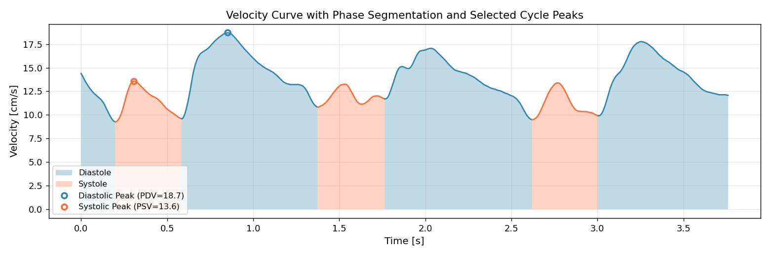Velocity curve with phase segmentation